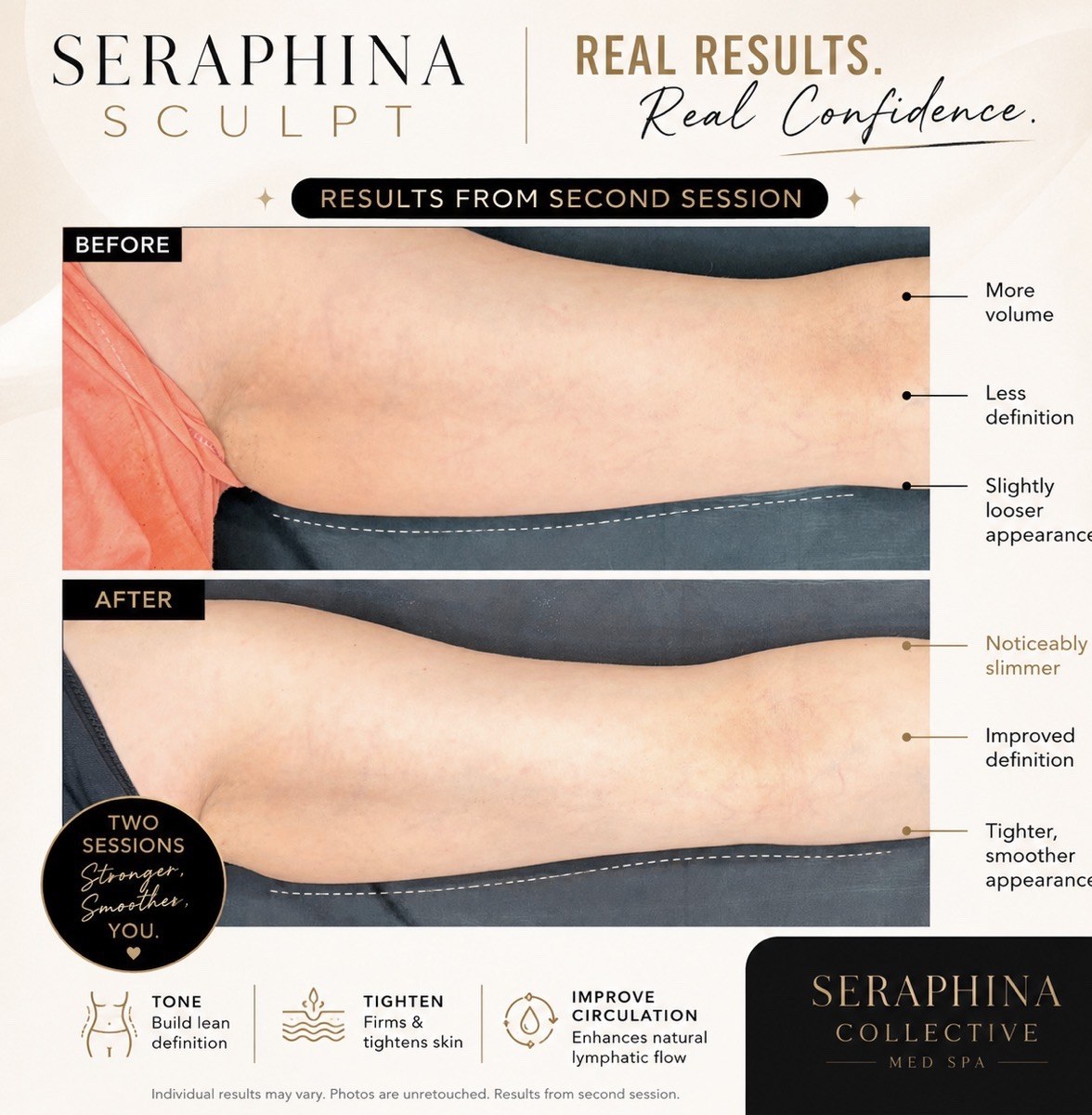 Body Sculpting — Second Session before and after result